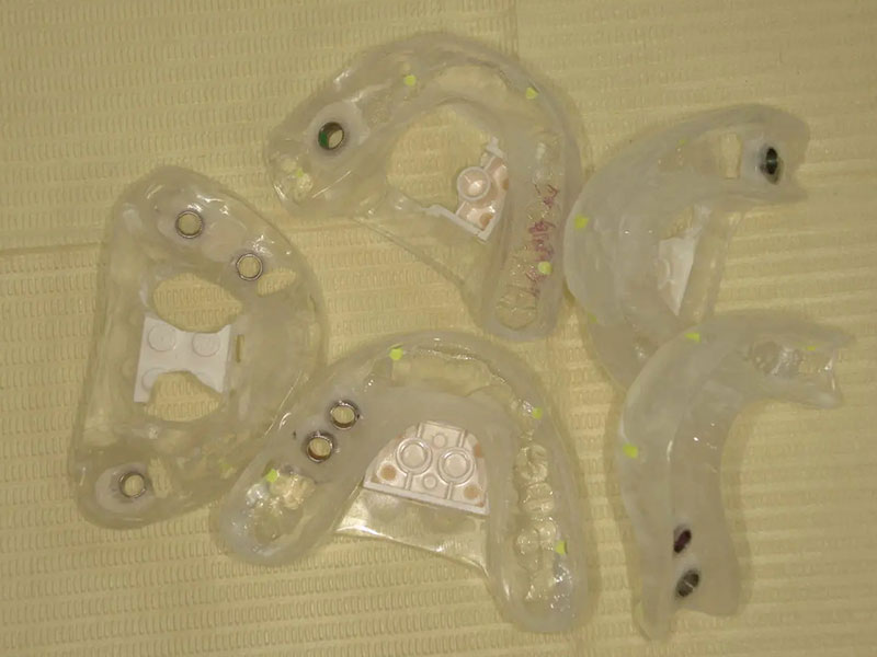 当院はサージカルガイドを使用しております