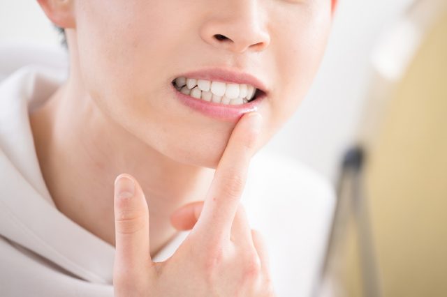歯周病とは？原因・症状・予防法を解説